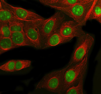 RbAp48/RBBP4 Antibody