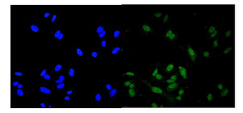 ROC1/RBX1 Rabbit Polyclonal Antibody