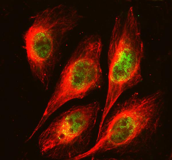 FOXA3 Rabbit Polyclonal Antibody