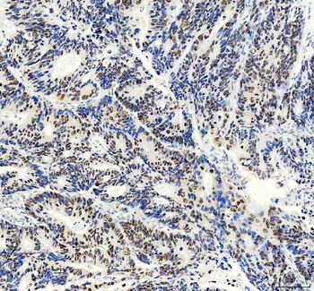 FOXA3 Rabbit Polyclonal Antibody