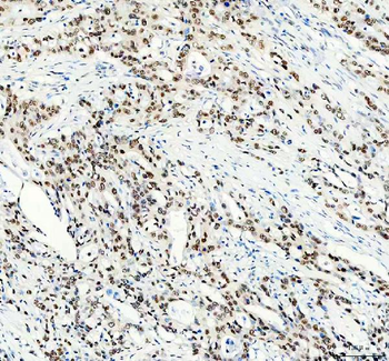 FOXA3 Rabbit Polyclonal Antibody