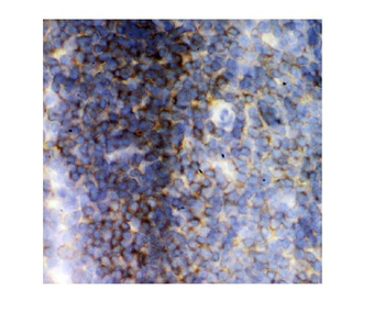 Lck Antibody