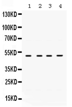 RRM2 Rabbit Polyclonal Antibody