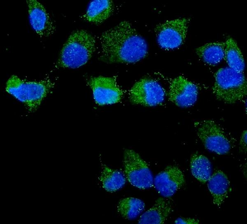 STXBP2 Rabbit Polyclonal Antibody