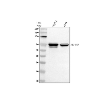 TGF beta Receptor II/TGFBR2 Antibody