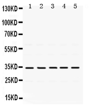 TIMP3 Rabbit Polyclonal Antibody