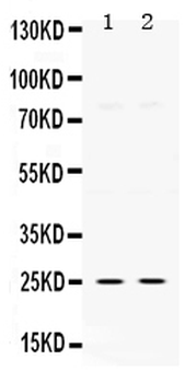 Thymidine Kinase 1/TK1 Rabbit Polyclonal Antibody
