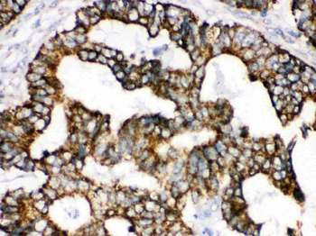 TRAP1 Rabbit Polyclonal Antibody