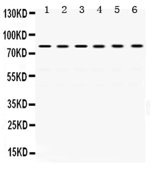 TRAP1 Rabbit Polyclonal Antibody
