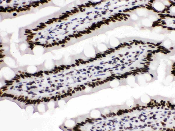 KAP1/TRIM28 Antibody