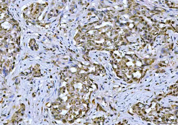 TIF1 gamma/TRIM33 Rabbit Polyclonal Antibody