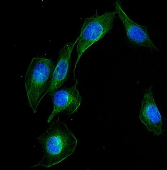 UBE2Q2 Rabbit Polyclonal Antibody