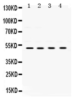 UBE2Q2 Rabbit Polyclonal Antibody