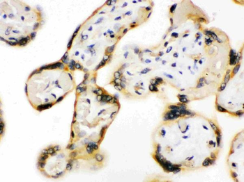 UPF3B/RENT3B Rabbit Polyclonal Antibody