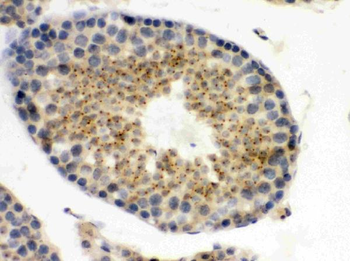 UPF3B/RENT3B Rabbit Polyclonal Antibody