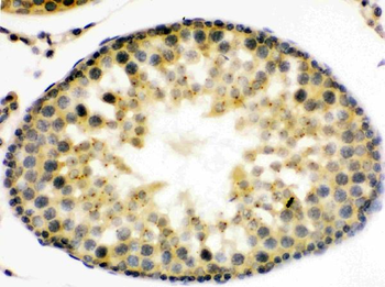 UPF3B/RENT3B Rabbit Polyclonal Antibody