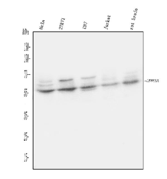 UPF3B/RENT3B Rabbit Polyclonal Antibody