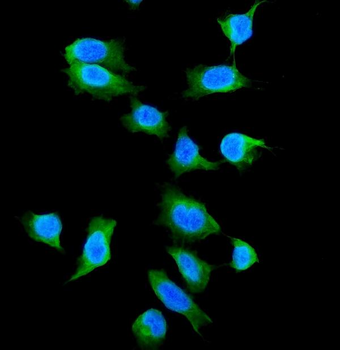 Galectin 1/LGALS1 Antibody