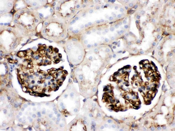 Apolipoprotein A I/APOA1 Rabbit Polyclonal Antibody