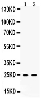 Apolipoprotein A I/APOA1 Rabbit Polyclonal Antibody