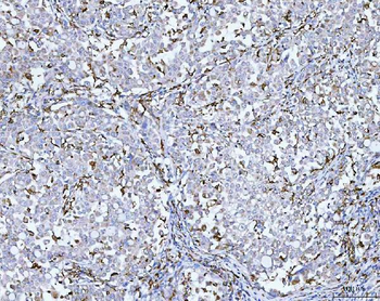 CD14 Rabbit Polyclonal Antibody