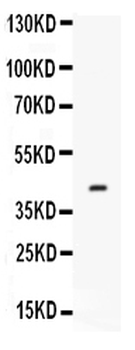 Factor D/CFD Rabbit Polyclonal Antibody