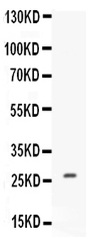 CNTF Rabbit Polyclonal Antibody