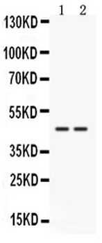 Cathepsin K/CTSK Rabbit Polyclonal Antibody