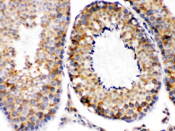 Smac/Diablo Rabbit Polyclonal Antibody