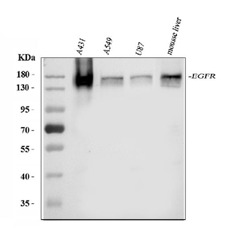 EGFR Rabbit Polyclonal Antibody