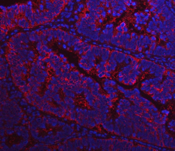 Fatty Acid Synthase/FASN Antibody