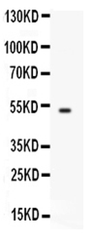 FCGRT Antibody