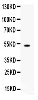 FCGRT Antibody