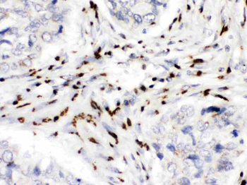 MDMX/MDM4 Rabbit Polyclonal Antibody