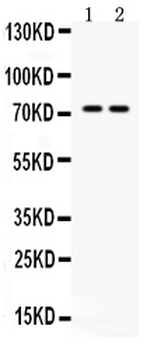 MDMX/MDM4 Rabbit Polyclonal Antibody