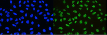 nmt55/p54nrb/NONO Rabbit Polyclonal Antibody