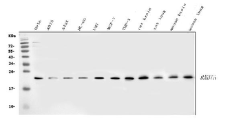 RAB7/RAB7A Antibody