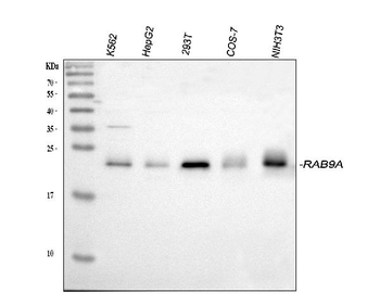 Rab9/RAB9A Rabbit Polyclonal Antibody