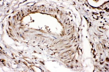 Ribonuclease Inhibitor/RNH1 Rabbit Polyclonal Antibody