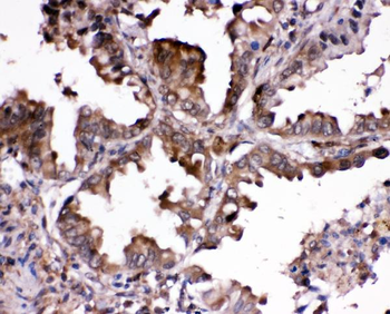 Ribonuclease Inhibitor/RNH1 Rabbit Polyclonal Antibody