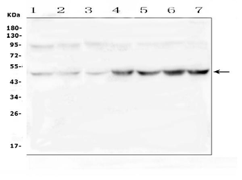 Ribonuclease Inhibitor/RNH1 Rabbit Polyclonal Antibody