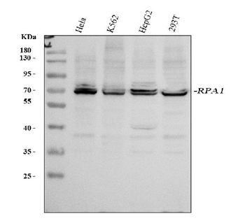 RPA70/RPA1 Rabbit Polyclonal Antibody