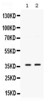 SIX1 Rabbit Polyclonal Antibody
