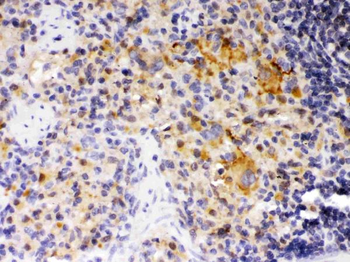 SKAP55/SKAP1 Rabbit Polyclonal Antibody