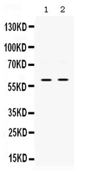 SKAP55/SKAP1 Rabbit Polyclonal Antibody