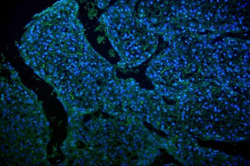 GLUT9/SLC2A9 Rabbit Polyclonal Antibody