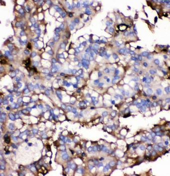 GLUT9/SLC2A9 Rabbit Polyclonal Antibody