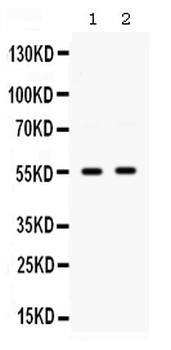 GLUT9/SLC2A9 Rabbit Polyclonal Antibody
