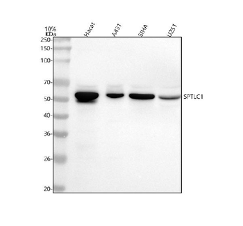 SPTLC1 Rabbit Polyclonal Antibody