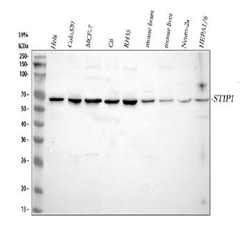 STIP1 Rabbit Polyclonal Antibody